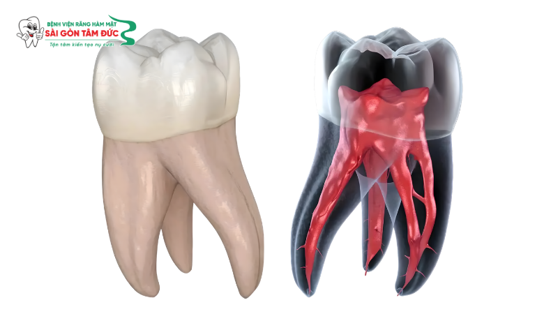1boc rang su co can lay tuy khong 1 benhvienranghammatsaigontamduc