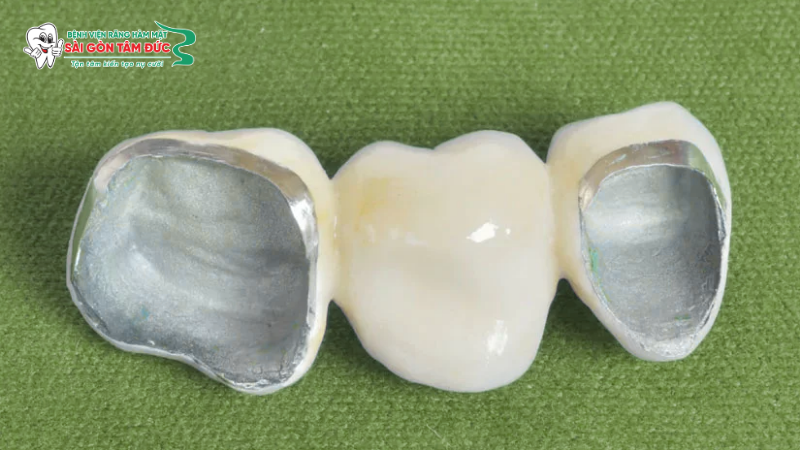 1boc rang su duoc bao lau 2 benhvienranghammatsaigontamduc