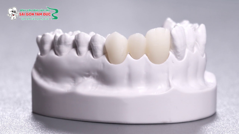 1boc rang su duoc bao lau 3 benhvienranghammatsaigontamduc