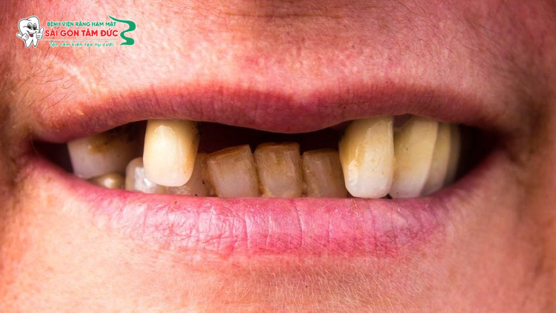 1ham khung thao lap 2 benhvienranghammatsaigontamduc