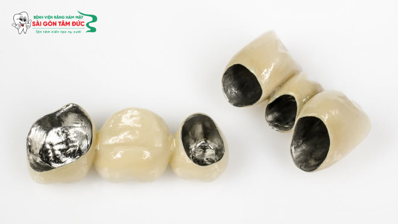 1phuc hinh rang su tren implant 2 benhvienranghammatsaigontamduc