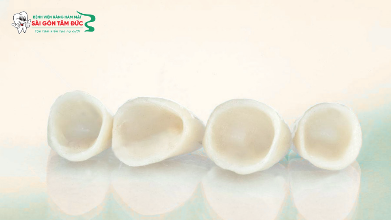 1phuc hinh rang su tren implant 3 benhvienranghammatsaigontamduc