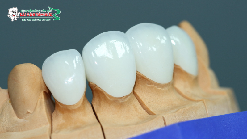 1rang toan su 1 benhvienranghammatsaigontamduc