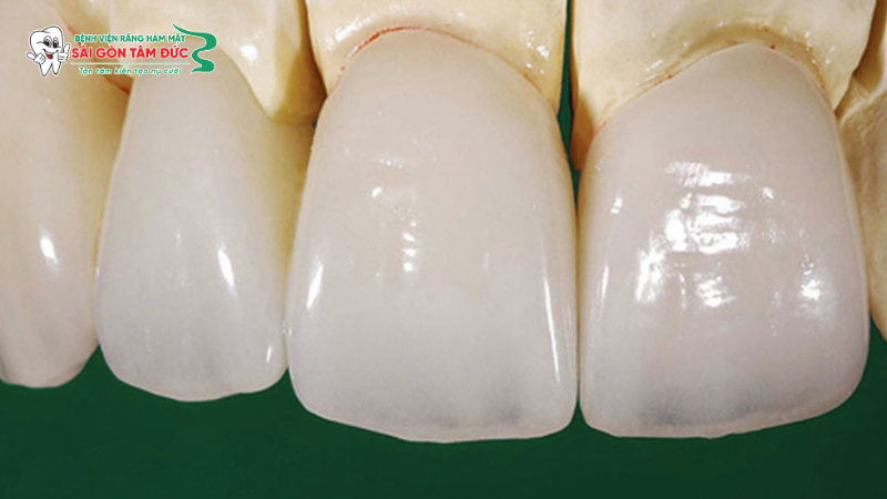 1rang toan su 4 benhvienranghammatsaigontamduc