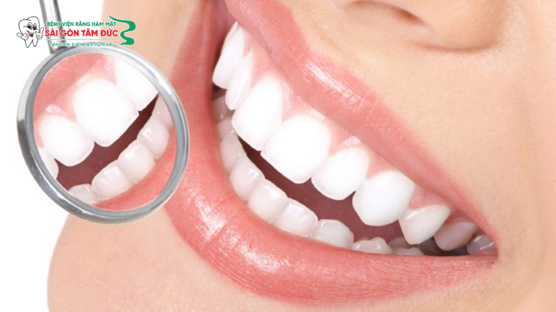 1tay trang rang 1 benhvienranghammatsaigontamduc