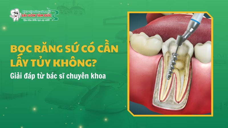 1thumb boc rang su co can lay tuy khong benhvienranghammatsaigontamduc