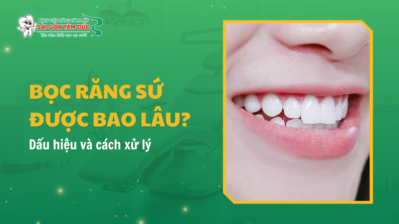 1thumb boc rang su duoc bao lau benhvienranghammatsaigontamduc