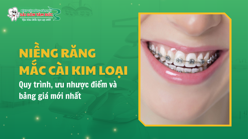 1thumb nieng rang mac cai kim loai benhvienranghammatsaigontamduc