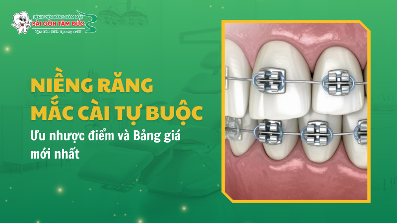 1thumb nieng rang mac cai tu buoc benhvienranghammatsaigontamduc