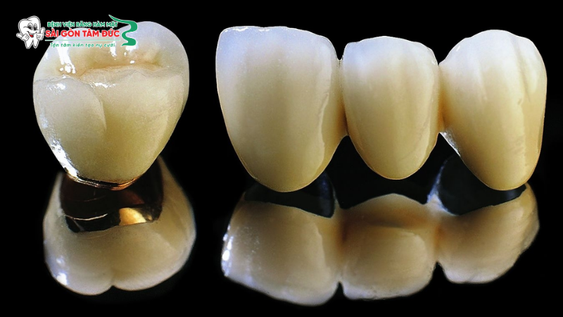 1titanium la gi 3 benhvienranghammatsaigontamduc