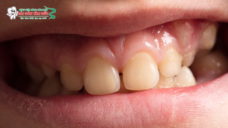 1tram rang tham my 5 benhvienranghammatsaigontamduc