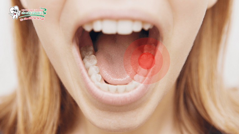 Đây là giai đoạn tủy đã bị tổn thương nghiêm trọng