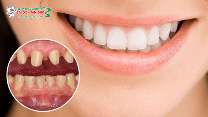 1dich vu boc rang su 2 benhvienranghammatsaigontamduc