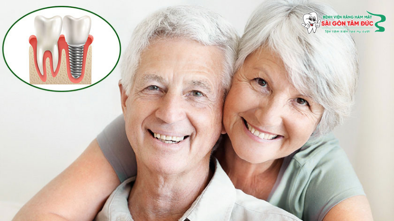 1dich vu trong rang implant 5 benhvienranghammatsaigontamduc