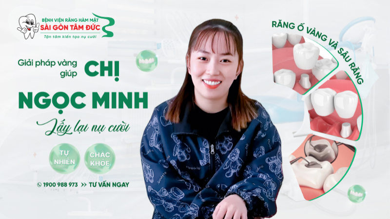 cau chuyen khach hang chi nm