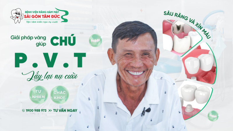 cau chuyen khach hang chu pvt